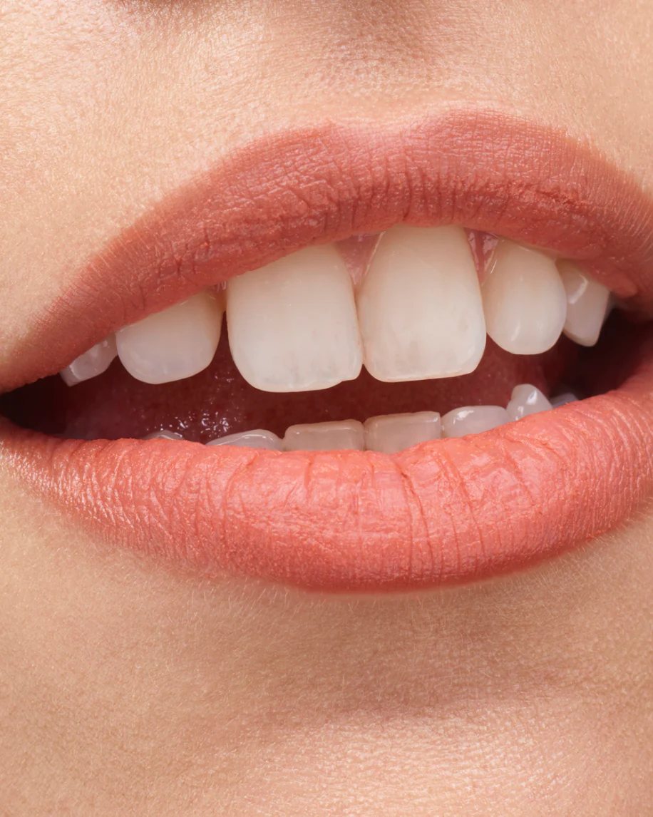 Generation G - Image 7